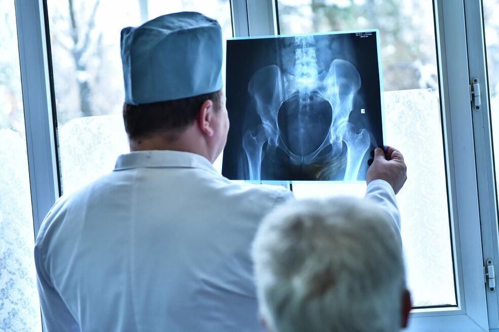 Az orvos egy arthrosisos csípőízület képét nézi