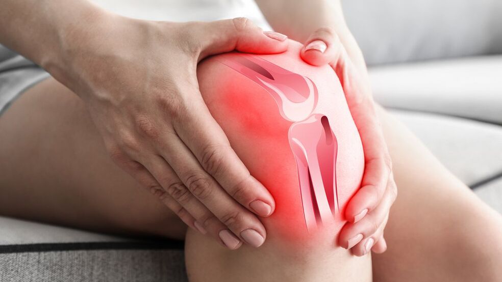 Ízületi fájdalmak kezelése Osteflex